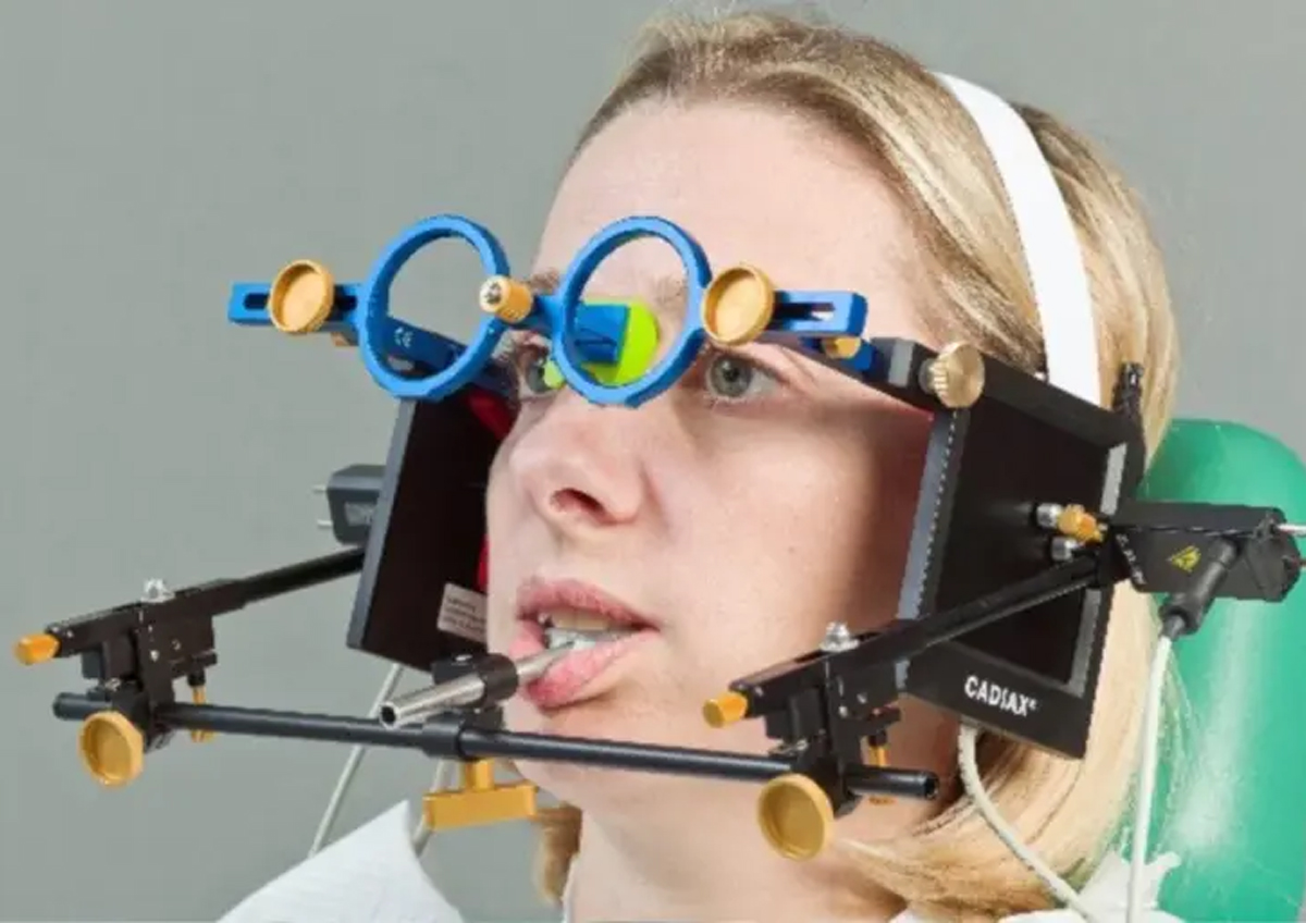 コンディログラフ