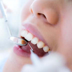 メインテナンス