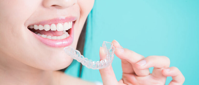 治療終了後の保定とアフターケア