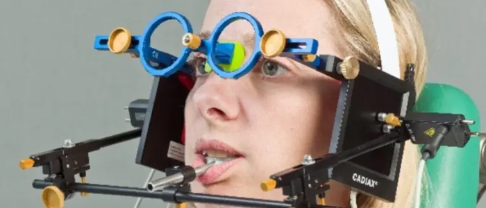 コンディログラフによる顎運動解析