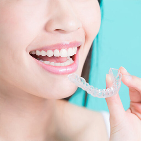 治療終了後の保定とアフターケア