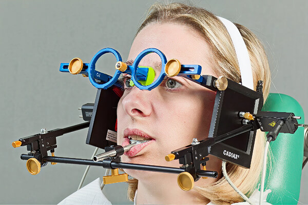 コンディログラフとは