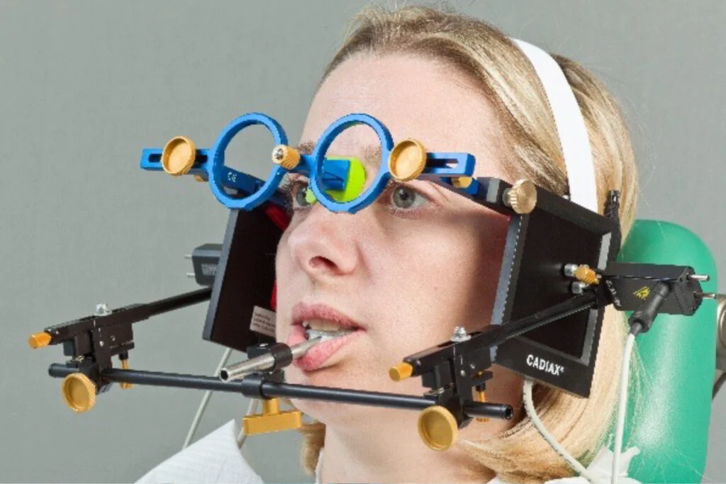 コンディログラフによる顎運動解析