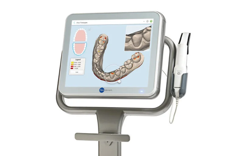 iTeroエレメント